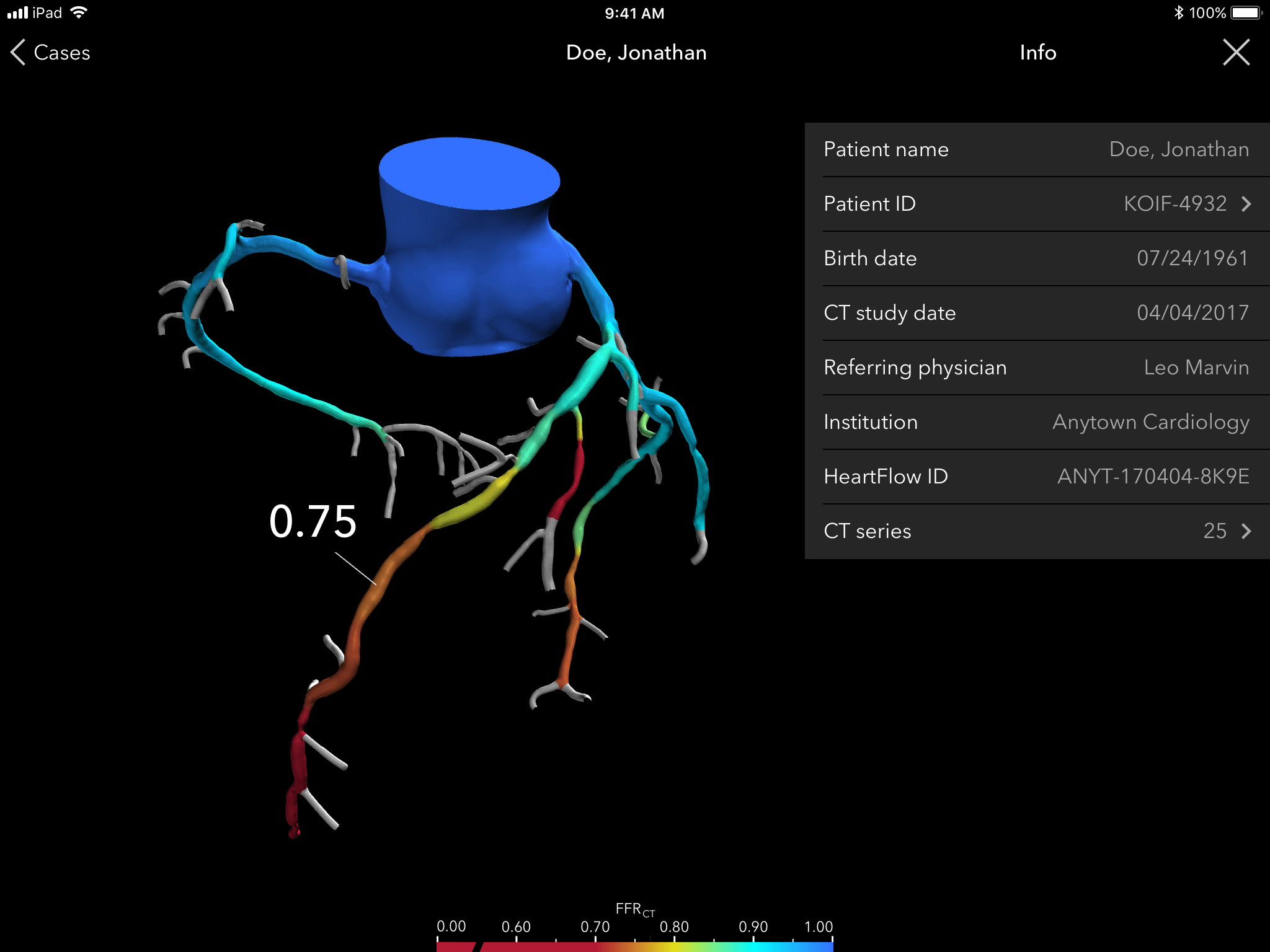 How 3D Heart Scans Are Reducing The Number Of Invasive Diagnostic Tests   IPad@4x 2048x1536 