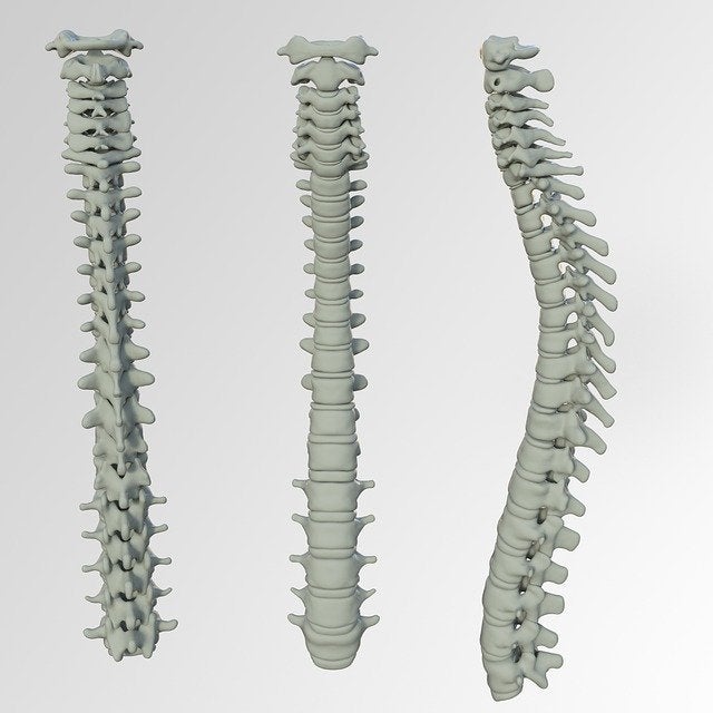 How much are spine implants? : r/PhotoshopFails
